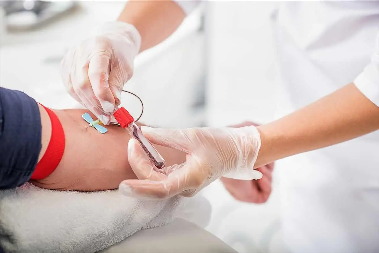 Esami del sangue: quali sono i test più completi e cosa possono rivelare sulla nostra salute
